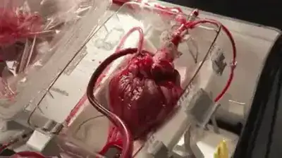 Wackelbilder & animierte Gifs – Gifdump.org #16 schlagendes herz